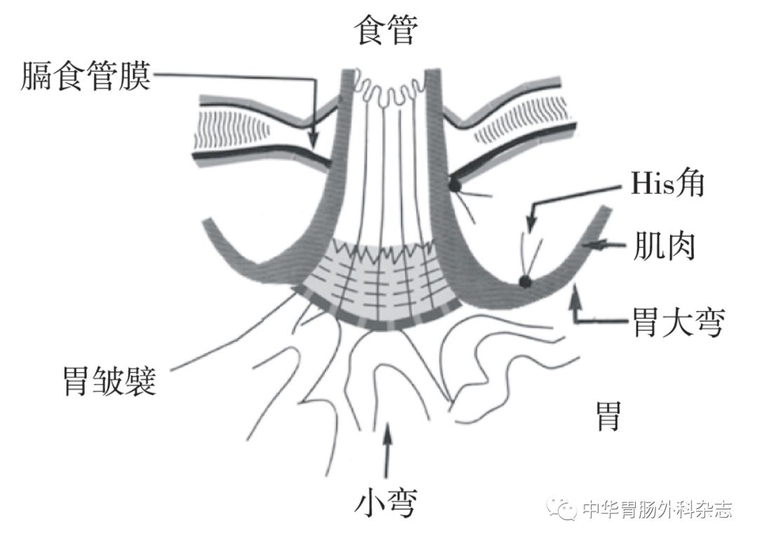 食管胃结合部的内面观[17]