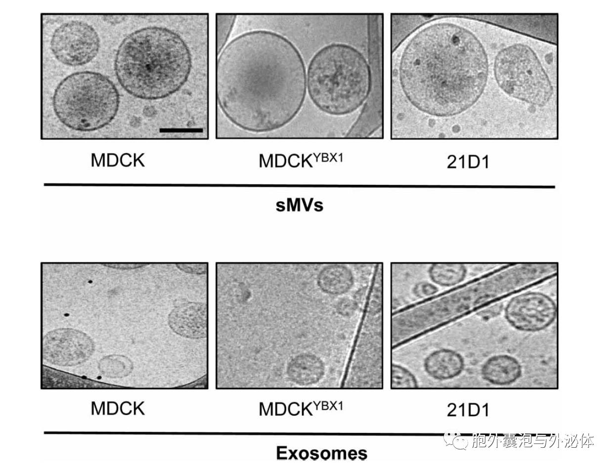 figure   来自mdck, mdckybx1,以及21d1细胞的胞外囊泡冷冻电子显微镜