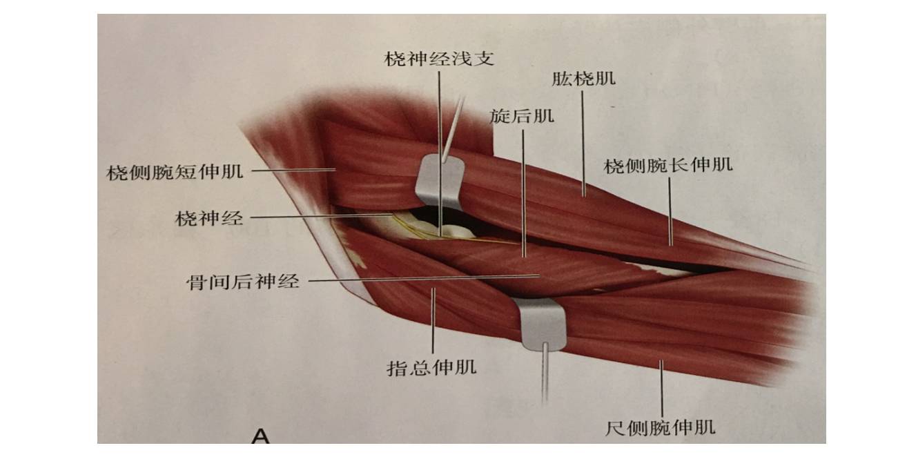 这样一个很重要的一个神经, 它进入旋后肌, 那么它进入旋后肌是在偏