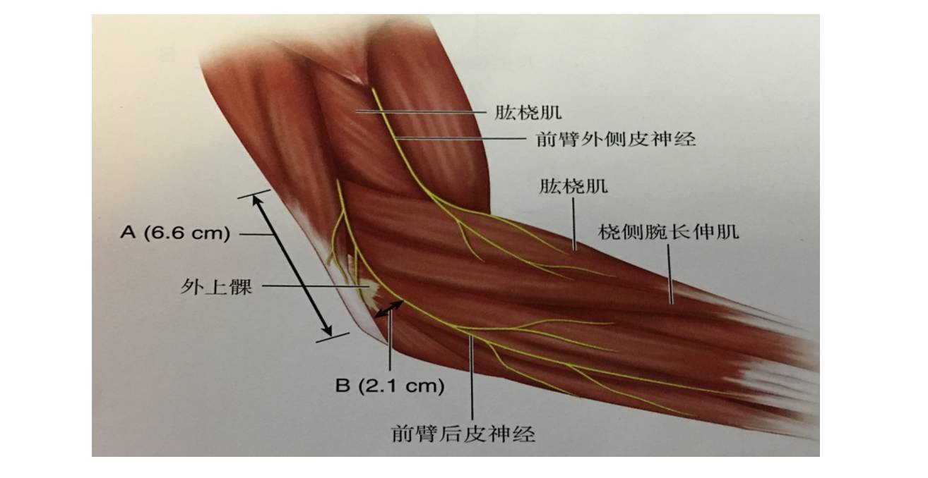 那么, 我们可以仔细去看, 在桡侧腕长伸肌和指总伸肌之间, 有一个 肌