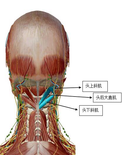 案例分析 一:寰枢椎错位与枕下三角 患者因为突然的旋转用力导致