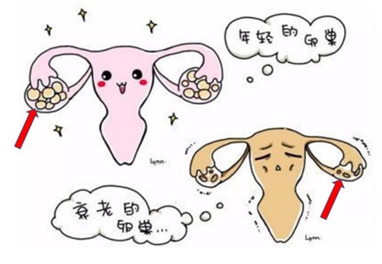 高龄女性，卵巢功能减退，想怀孕有办法吗？
