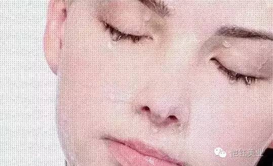 水光针，到底价格重要还是效果重要？