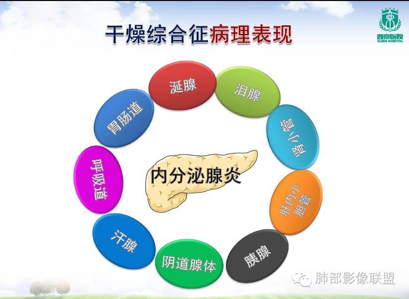 原发性干燥综合症的肺部损害