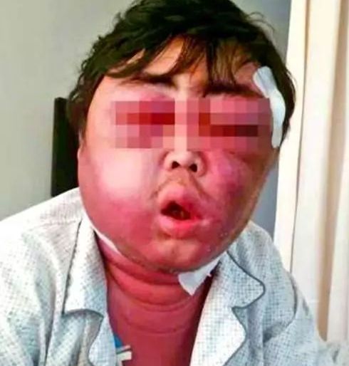 出现这些症状, 说明体内有癌细胞！可选安惠凯恩赛诺！