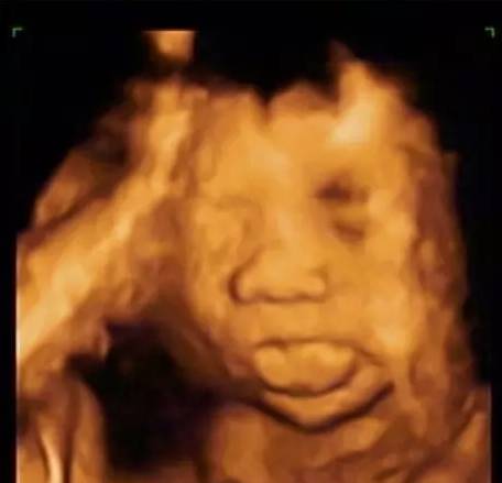 看图上只是一个23周的胎儿,当然也可以有非常丰富的表情.