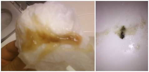 清鼻涕,黄鼻涕,1分钟教你辨别宝宝鼻涕的秘密