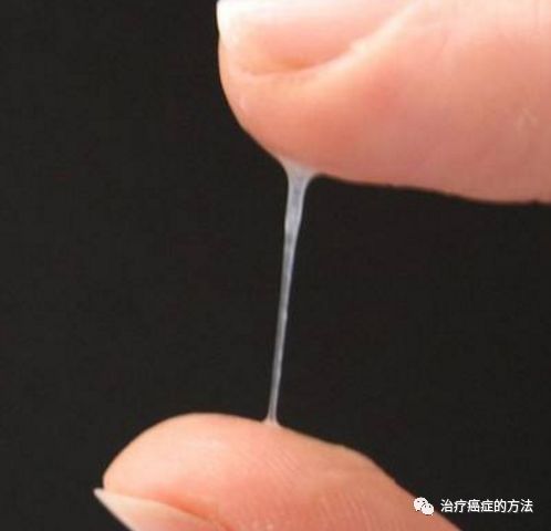 女人有这4种美女的样子,当心宫颈癌,现在防癌还来得及撒真人白带图片