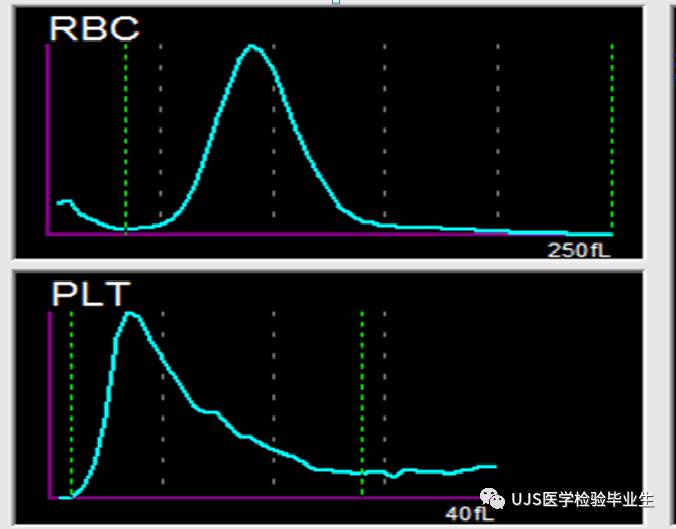 由三个案例,浅谈血小板直方图的意义