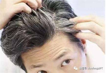 白头发真的会拔1根长3根