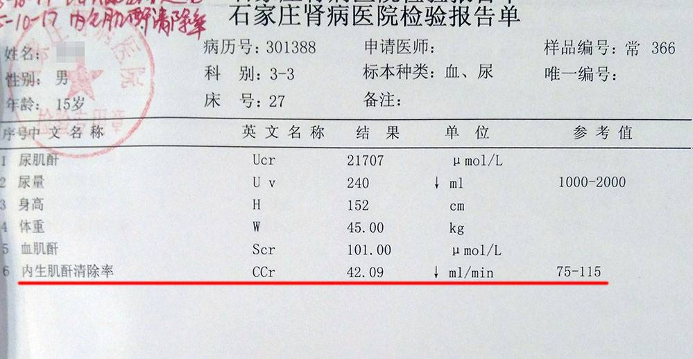 肌酐要这样化验,才最准确