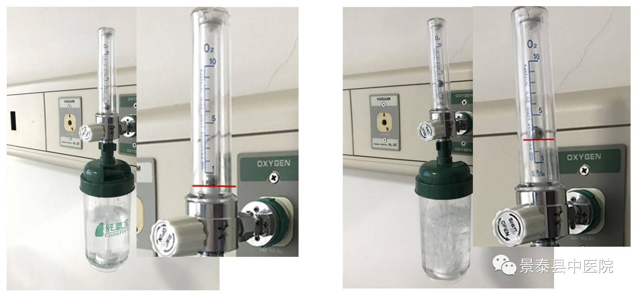 壁式吸氧怎么装【护理】调节氧流量，浮球对应哪个平面读数才准确？_https://www.jmylbn.com_新闻资讯_第6张