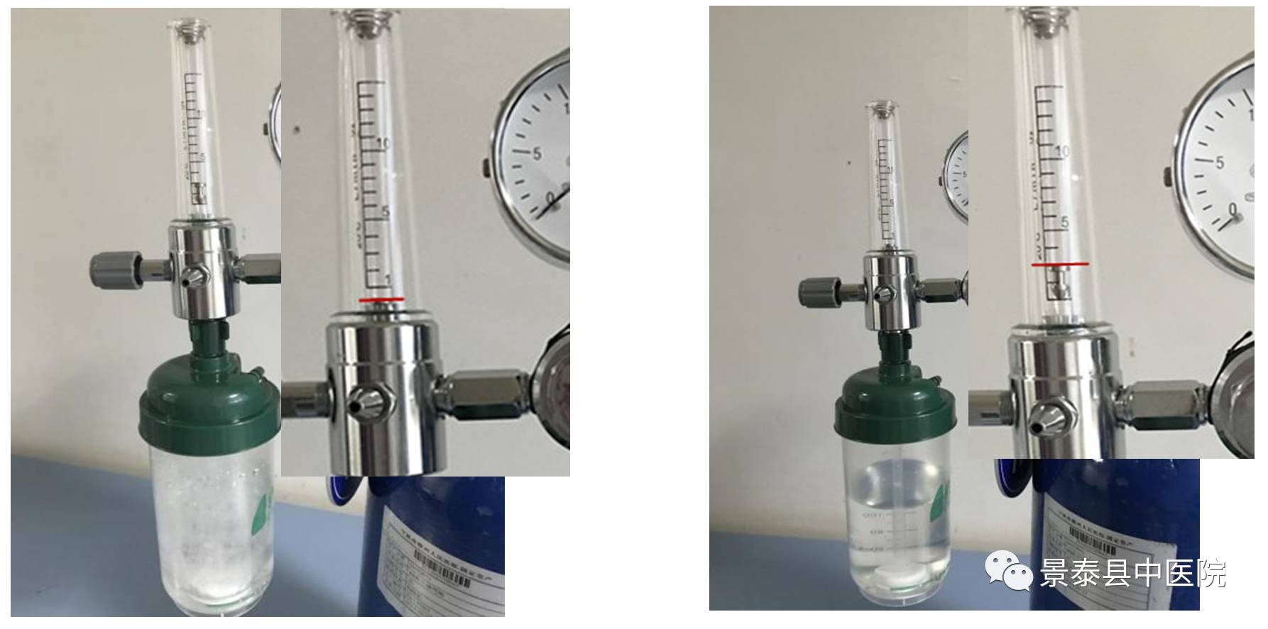壁式吸氧怎么装【护理】调节氧流量，浮球对应哪个平面读数才准确？_https://www.jmylbn.com_新闻资讯_第7张