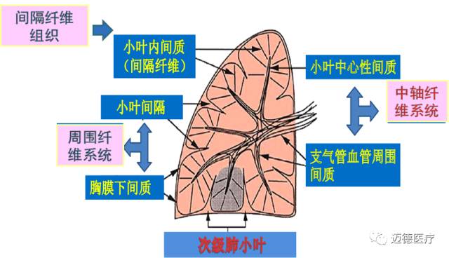 呼吸肺间质改变的基本ct表现