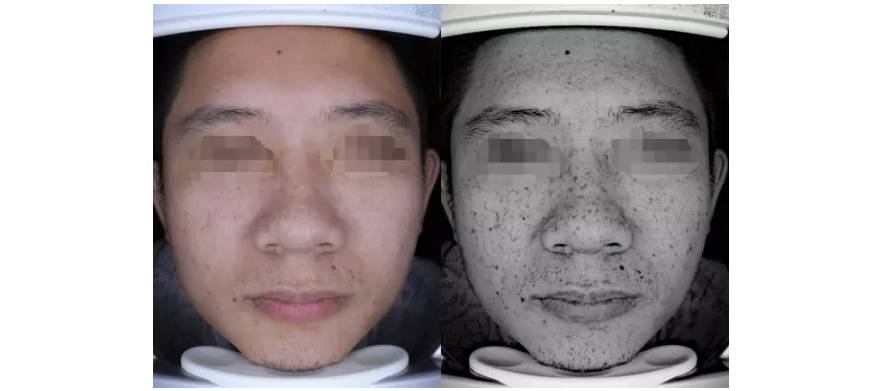 男人皮肤如何保养_男人如何护肤保养皮肤_经期护肤保养