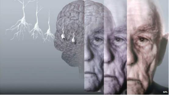 前赴后继的老年痴呆研究，中医药抢占一席之地