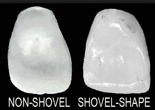 比较明显的特点就是铲形门齿(sinodonty),这一独特特点在各种不同年代