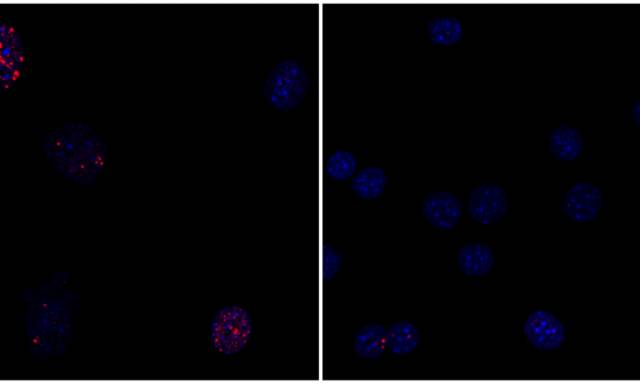 加州 Salk Institute 首次通过“细胞重编程” 实现返老还童