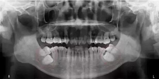 怎么选洁牙器械【诺美口腔·4店适用】49.9元享洁牙套餐：口腔健康档案、全口口腔问题诊断、无菌治疗器械、成人超声波洁牙...._https://www.jmylbn.com_新闻资讯_第30张