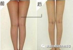 09172707692_21天減肥法_小孩能吃蒲地藍嗎