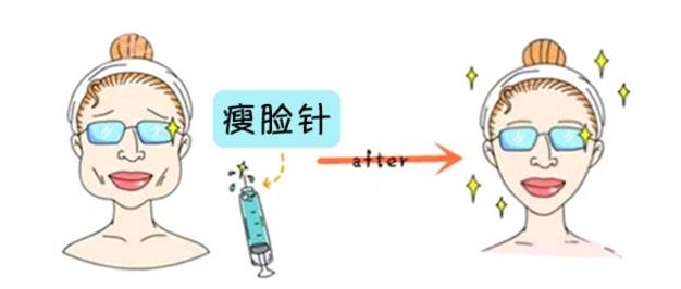 打瘦脸针后脸僵真相凸?颧骨其实是这样什么型血吃ov瘦脸图片