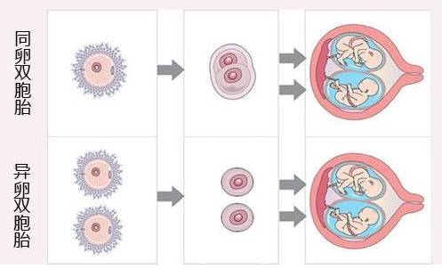 生双胞胎感觉很完美,这其中的风险你可知?