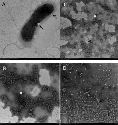 图1. 电镜下观察到罗尼氏弧菌分泌外膜囊泡（A）；20℃和30℃培养条件下可形成两种形态的膜外囊泡（B,C）;膜外囊泡有独立囊泡和囊泡链两种存在形式