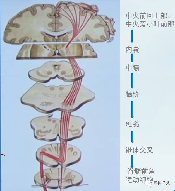 发出以后往下经过内囊,穿过内囊以后到中脑,然后到脑桥,延髓,椎体交叉