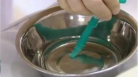 怎么拔鼻腔引流管胃管术（二）_https://www.jmylbn.com_新闻资讯_第13张