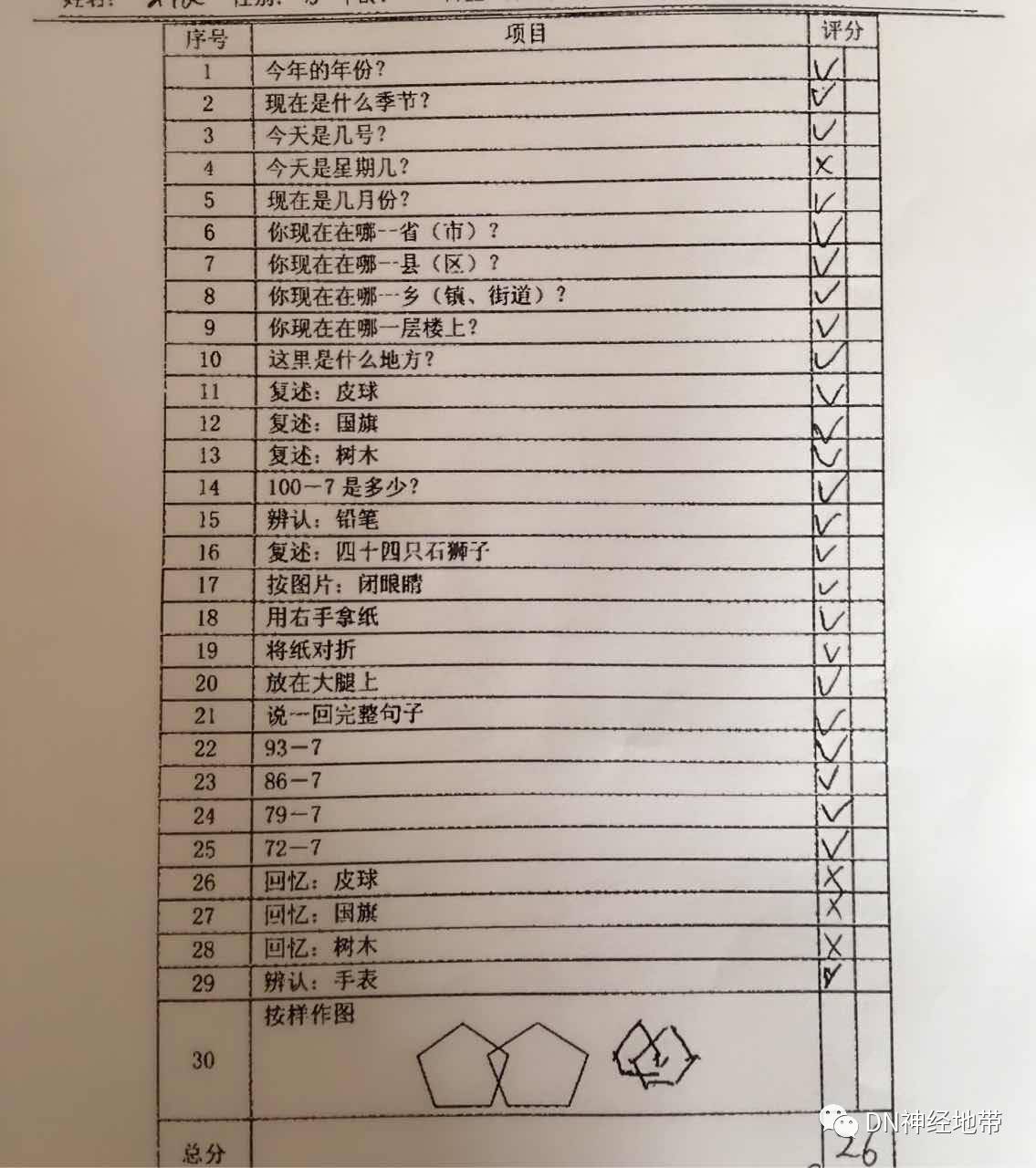 心前区无隆起,心尖搏动位于左侧锁骨中线内1cm,心浊音界不大,心前区