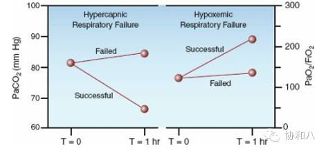 bipap英语怎么读解读BiPAP（2）：操纵机器的妙手 ｜ 一页手册·协和八_https://www.jmylbn.com_新闻资讯_第7张