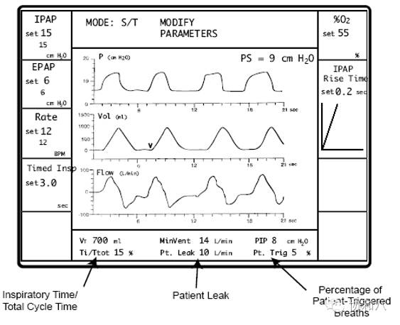 bipap英语怎么读解读BiPAP（2）：操纵机器的妙手 ｜ 一页手册·协和八_https://www.jmylbn.com_新闻资讯_第2张