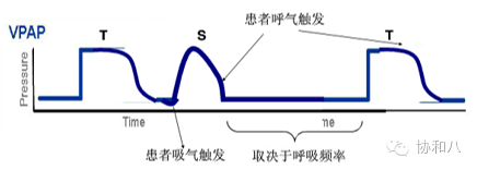 bipap英语怎么读解读BiPAP（1）：奄奄一息时，你的呼吸谁做主 ｜ 一页手册·协和八_https://www.jmylbn.com_新闻资讯_第12张