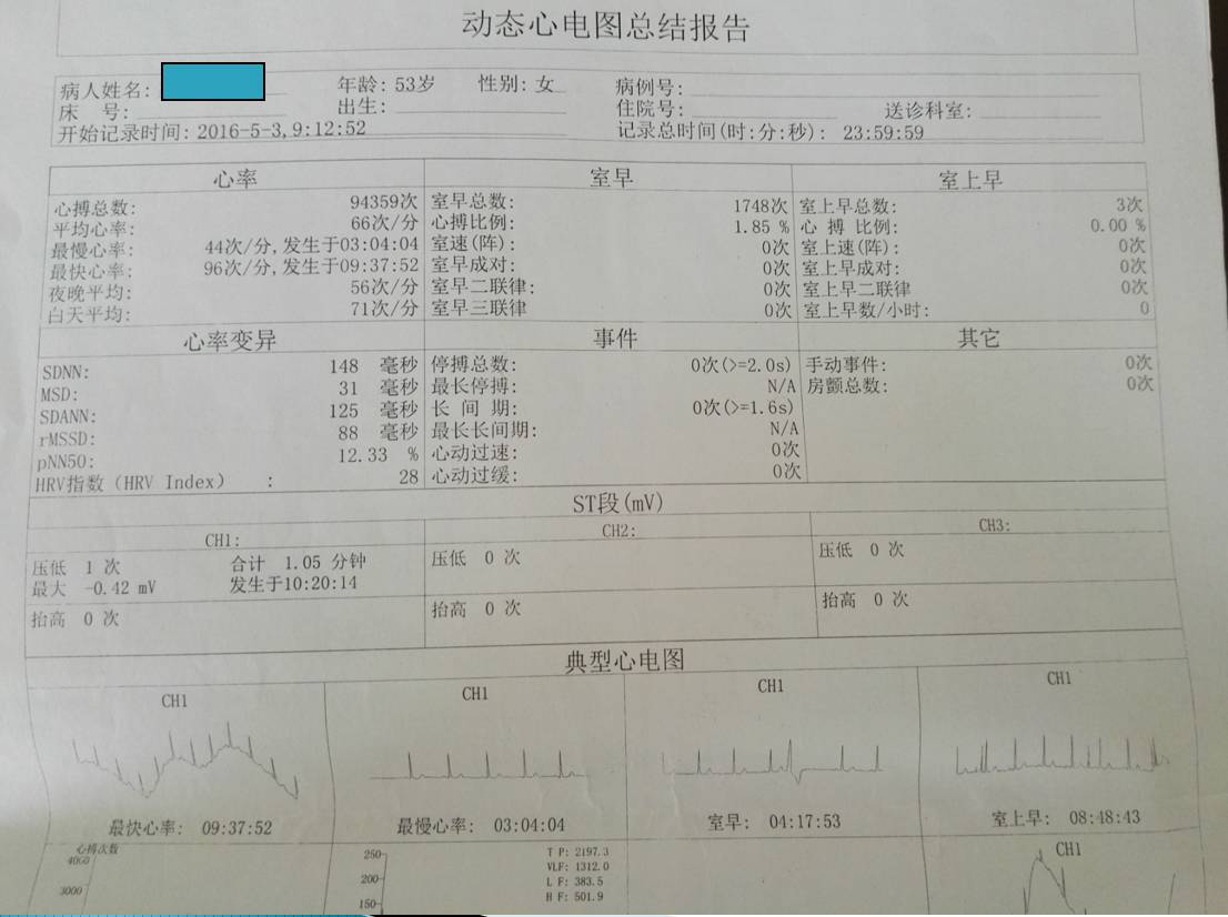 联合参松养心胶囊治疗冠心病室性早搏一例