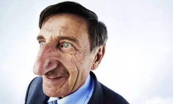 鼻炎误区，你闯了吗？