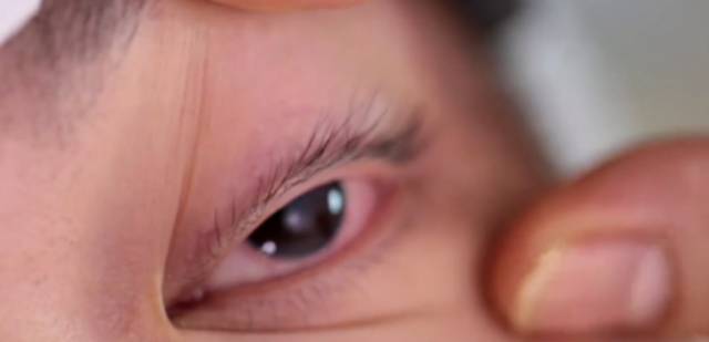 笑气能让留学生致瘫，星巴克也每天都在用