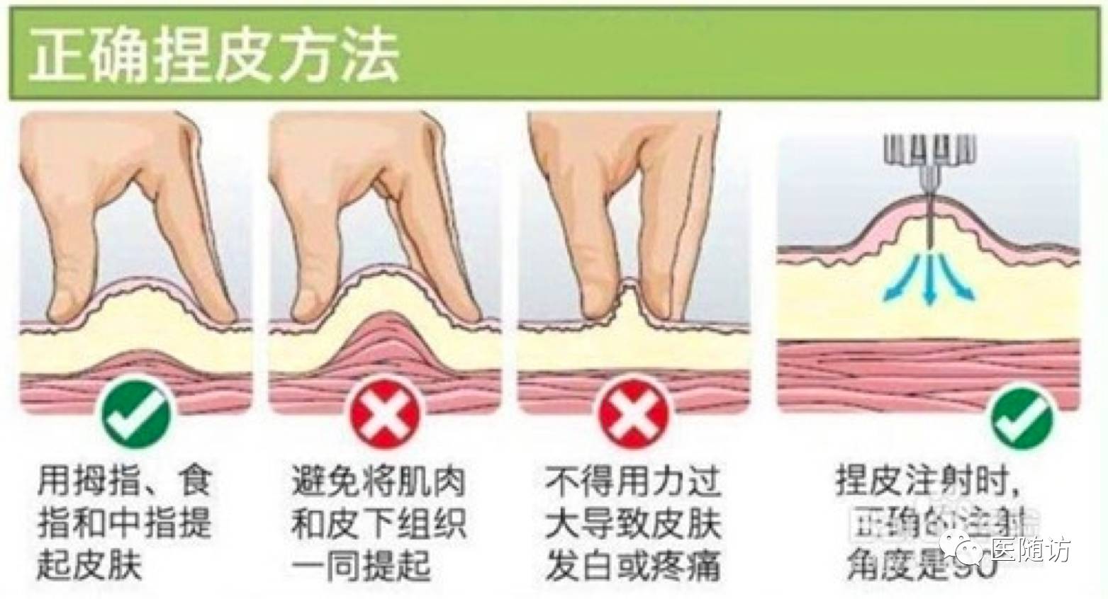 注射时的进针角度