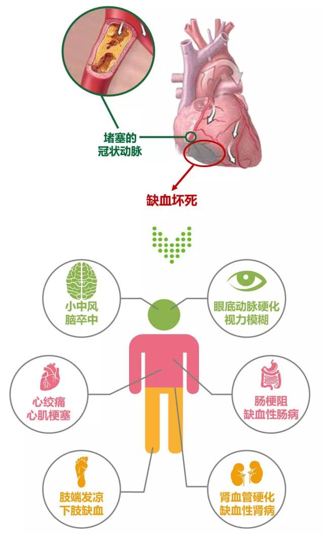 血管堵塞太可怕三七丹参把您帮