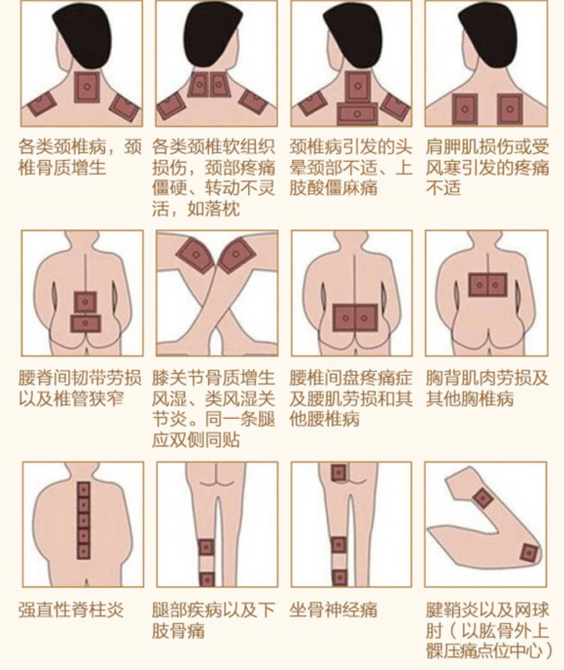 他把香港热销的古传中医秘方带回内地,用一贴膏药,处理了百万人久治不