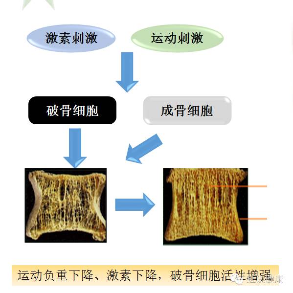 由于以上多种原因的影响,会造成破骨细胞活性的增强,从而紊乱成骨与