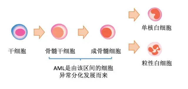 圖1 急性髓性白血病的起源jpg 圖1 急性髓性白血病的起源jpg