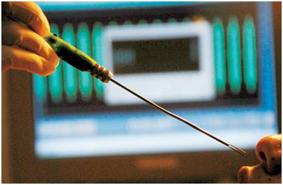 为什么手术用电刀【看刀】医生常用的十种手术刀大揭秘_https://www.jmylbn.com_新闻资讯_第12张