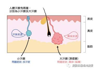 狐臭药物治疗可以根治吗_狐臭治疗药物_狐臭药物治疗的方法