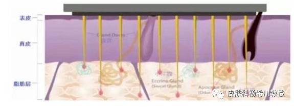 狐臭药物治疗可以根治吗_狐臭药物治疗的方法_狐臭治疗药物