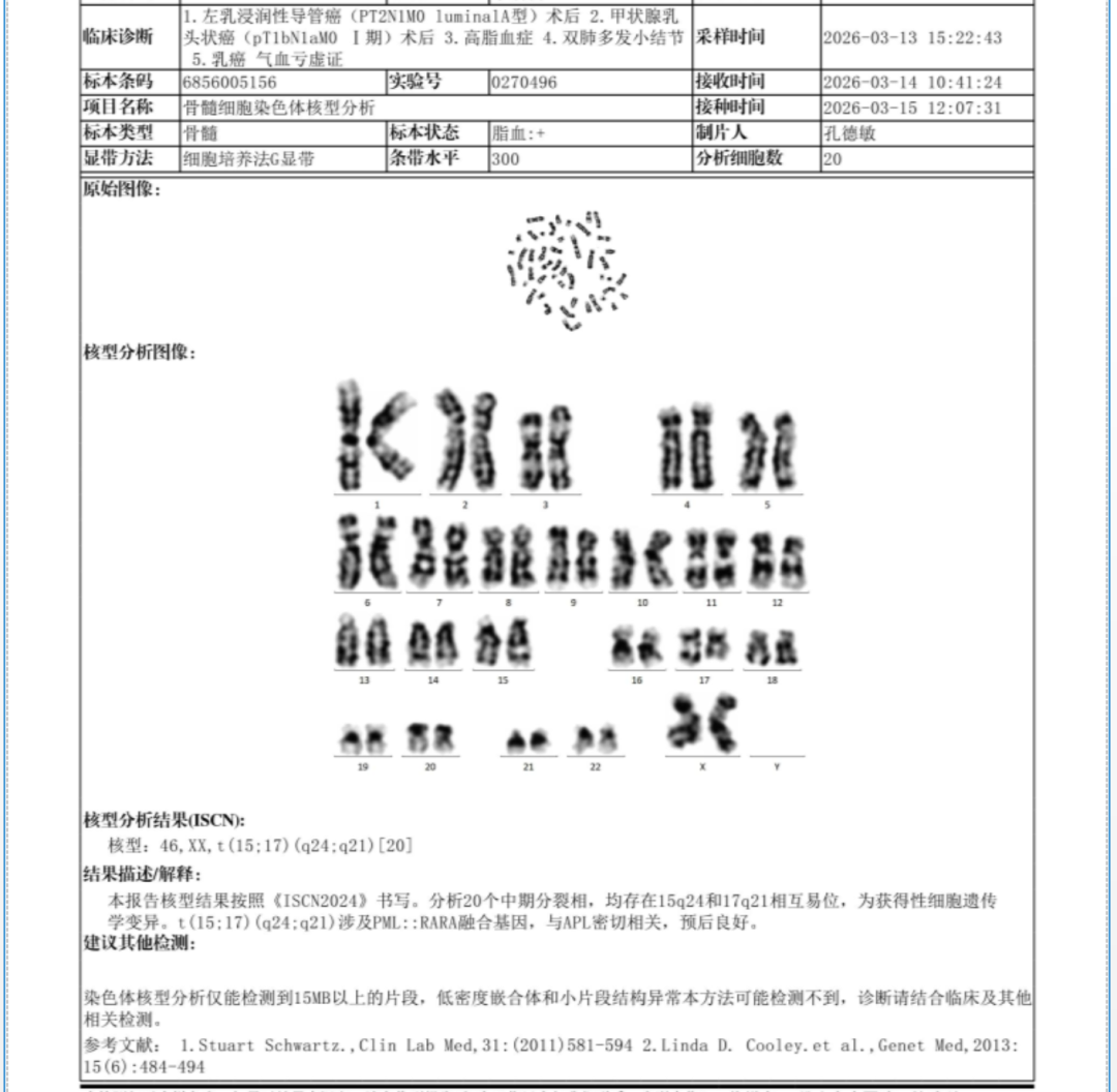 骨髓细胞染色体核型分析报告