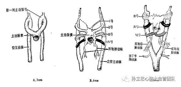 右侧形成右锁骨下动脉起始部,而左侧形成主动脉弓;第5对弓动脉完全