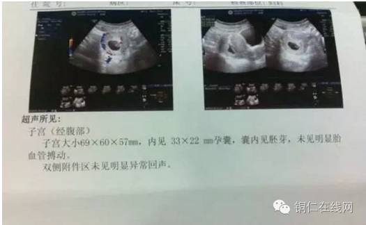 铜仁一老板娘怀孕三次全都流产,竟是因为…-怀孕期