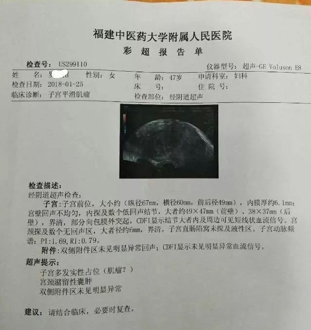 美宝案例---子宫肌瘤,23年脑梗三高,牛皮癣,脑出血高血压