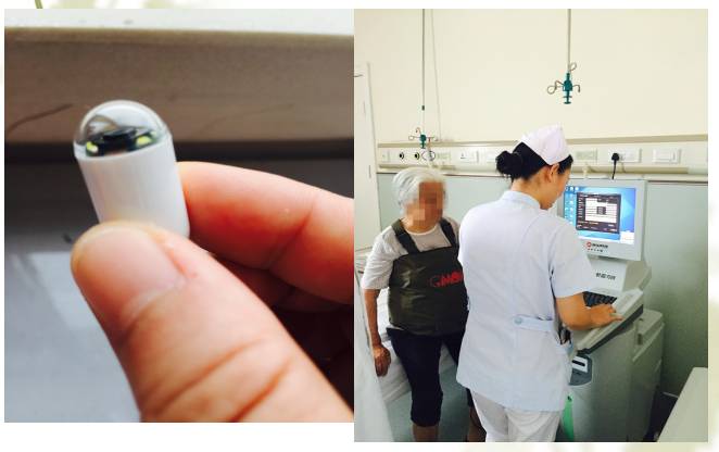无创无痛不麻醉——青岛市第三人民医院消化内科引进胶囊内镜新技术