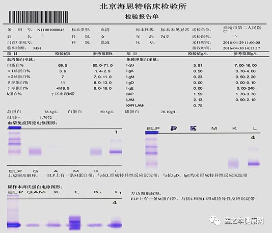 血清,尿免疫固定电泳:elp上有1条m带,与抗l形成特异性反应沉淀带.